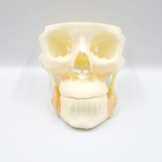 Guias de osteotomia ortognática